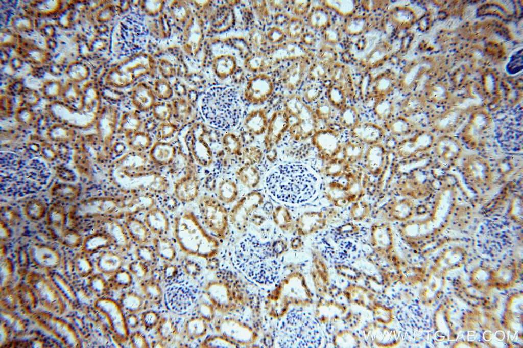 IHC staining of human kidney using 20396-1-AP