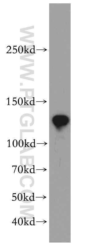 WB analysis of mouse testis using 20396-1-AP