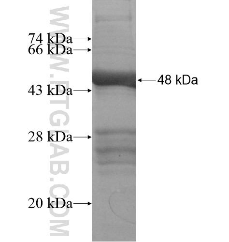 CCDC158 fusion protein Ag14004 SDS-PAGE