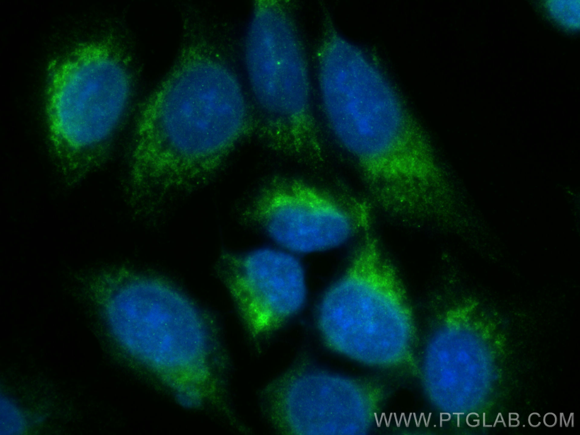 IF Staining of U2OS using 31922-1-AP