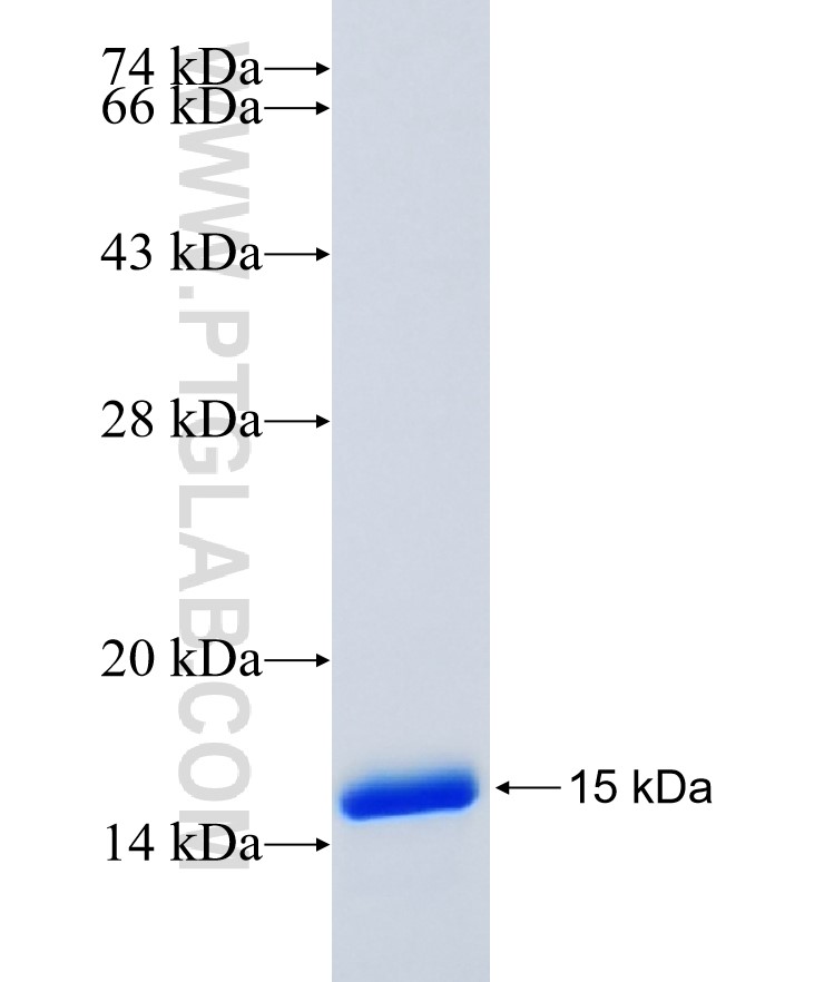 C6orf129 fusion protein Ag36859 SDS-PAGE C6orf129 fusion protein Ag36859 SDS-PAGE
