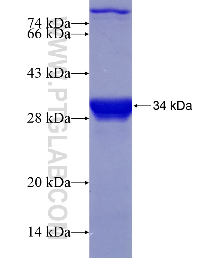 CCDC171 fusion protein Ag28964 SDS-PAGE CCDC171 fusion protein Ag28964 SDS-PAGE