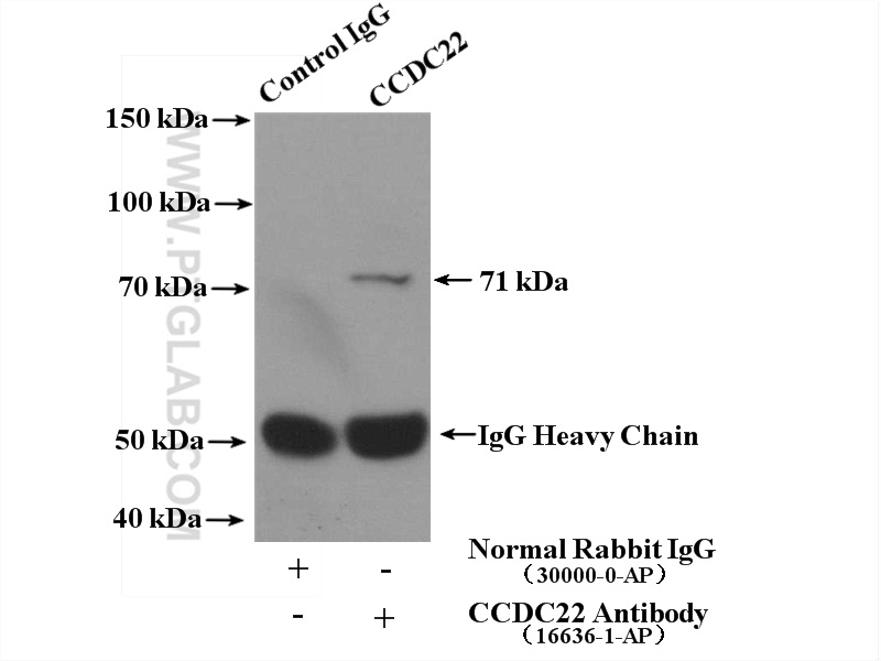 IP experiment of mouse lung using 16636-1-AP