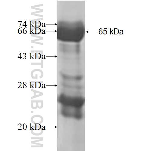 CCDC22 fusion protein Ag9980 SDS-PAGE