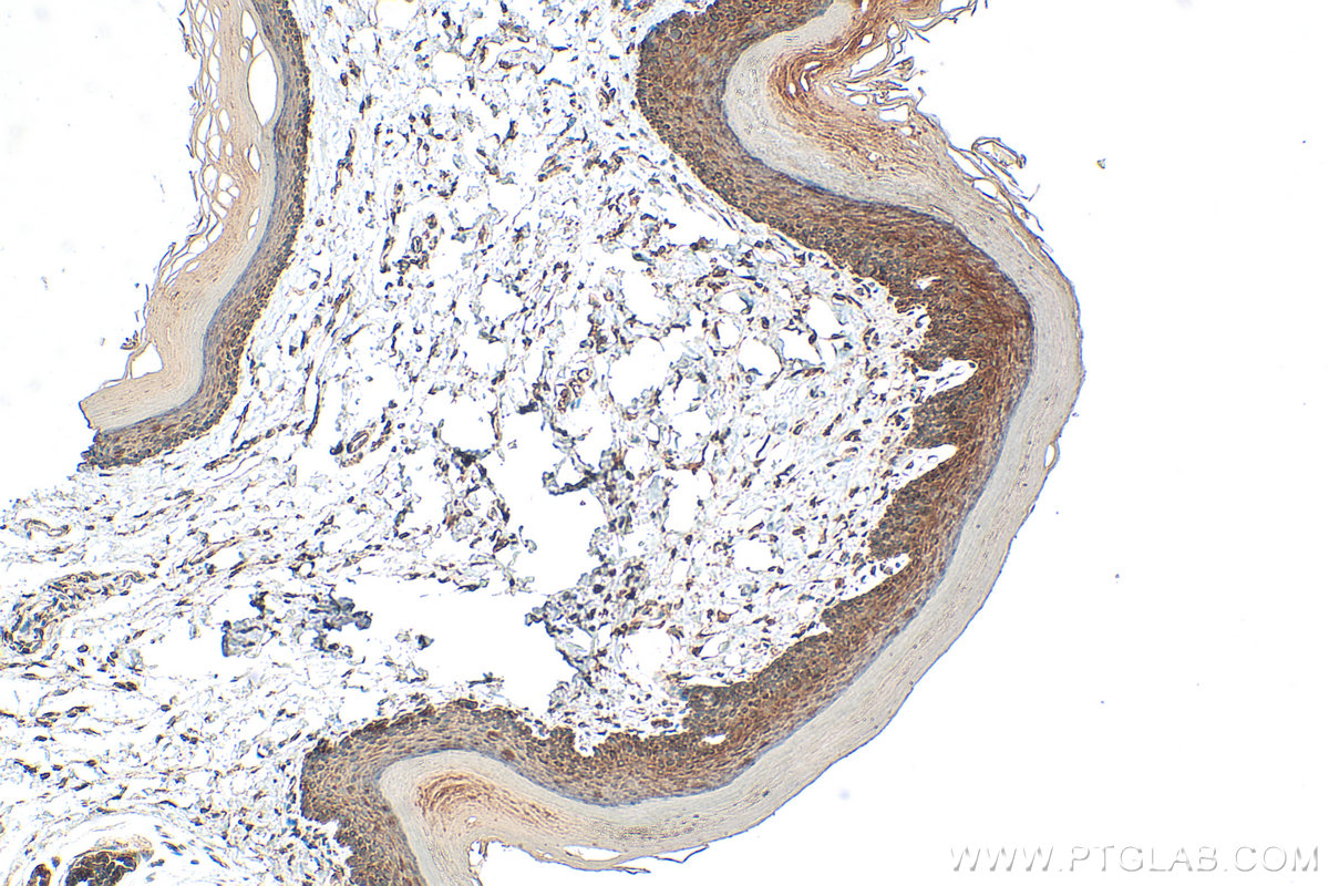 IHC staining of mouse skin using 30688-1-AP