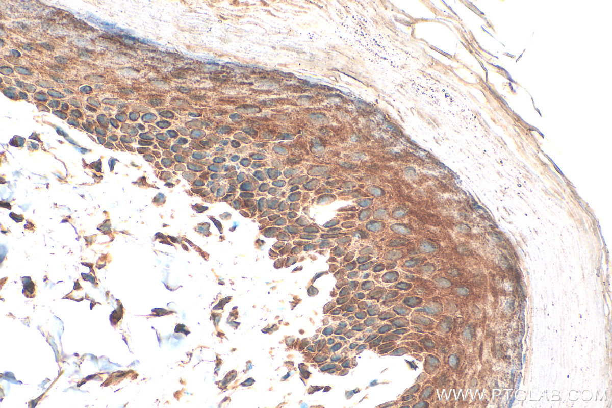 IHC staining of mouse skin using 30688-1-AP