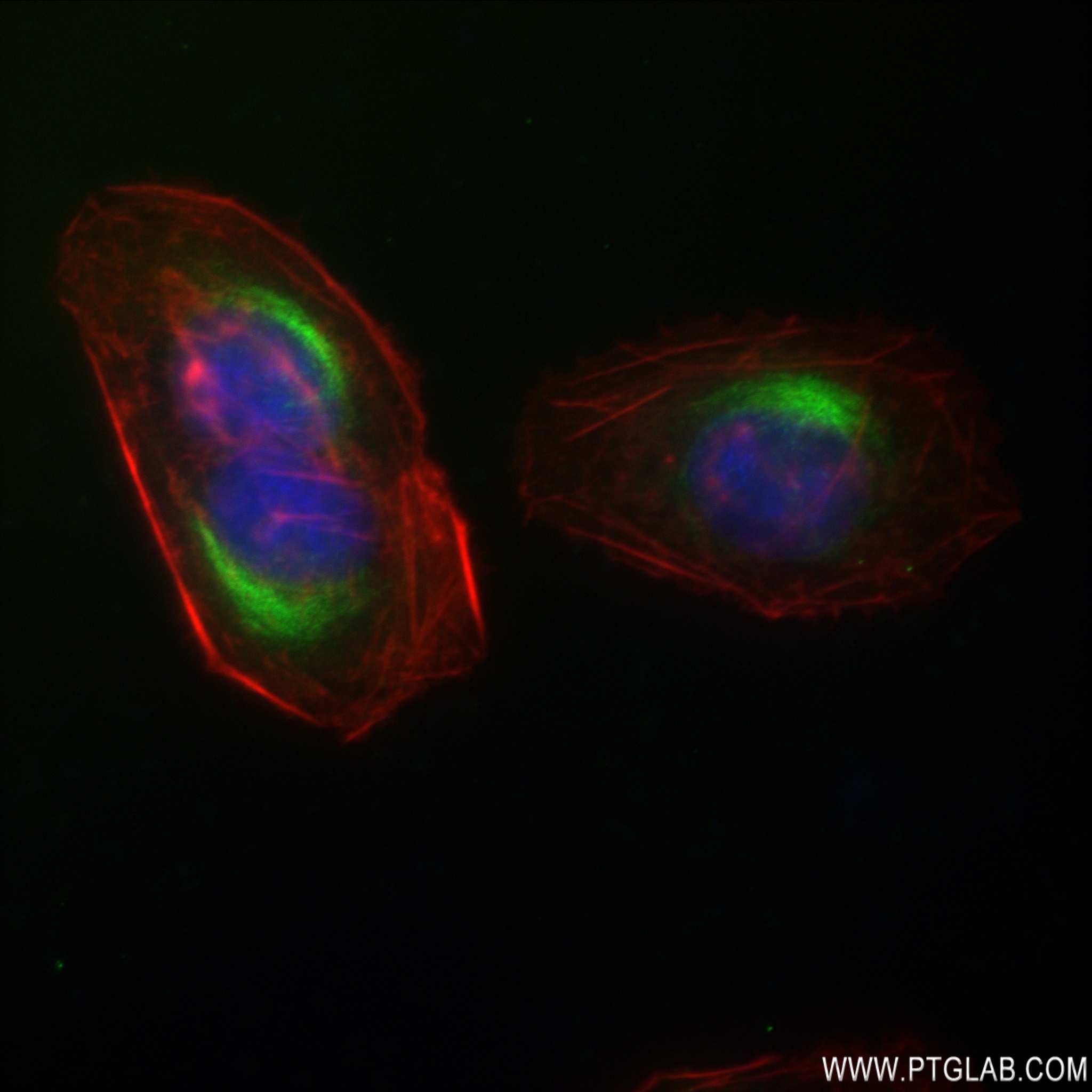 IF Staining of U2OS using 82998-4-RR