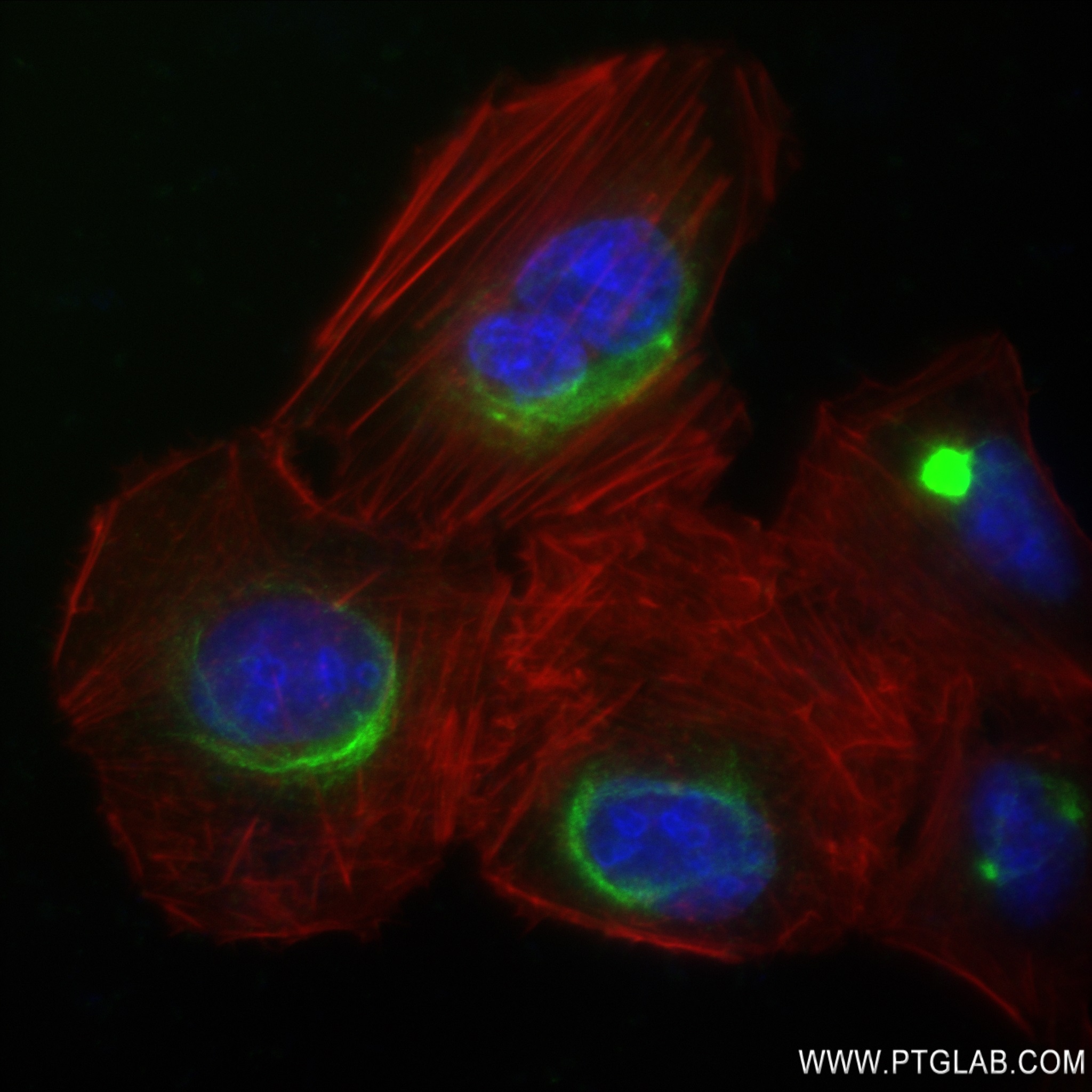 IF Staining of U2OS using 82998-4-RR