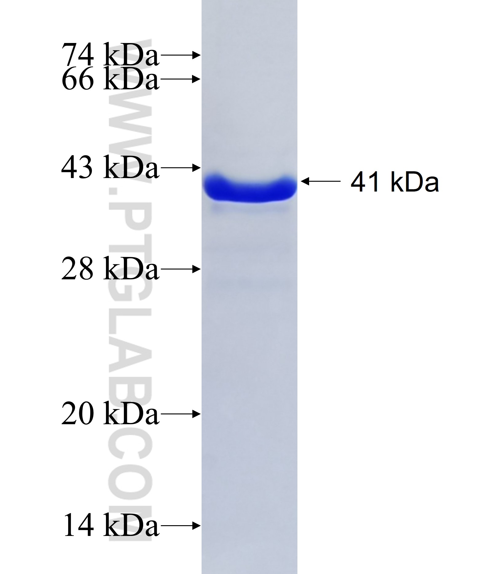 CCDC25 fusion protein Ag15593 SDS-PAGE