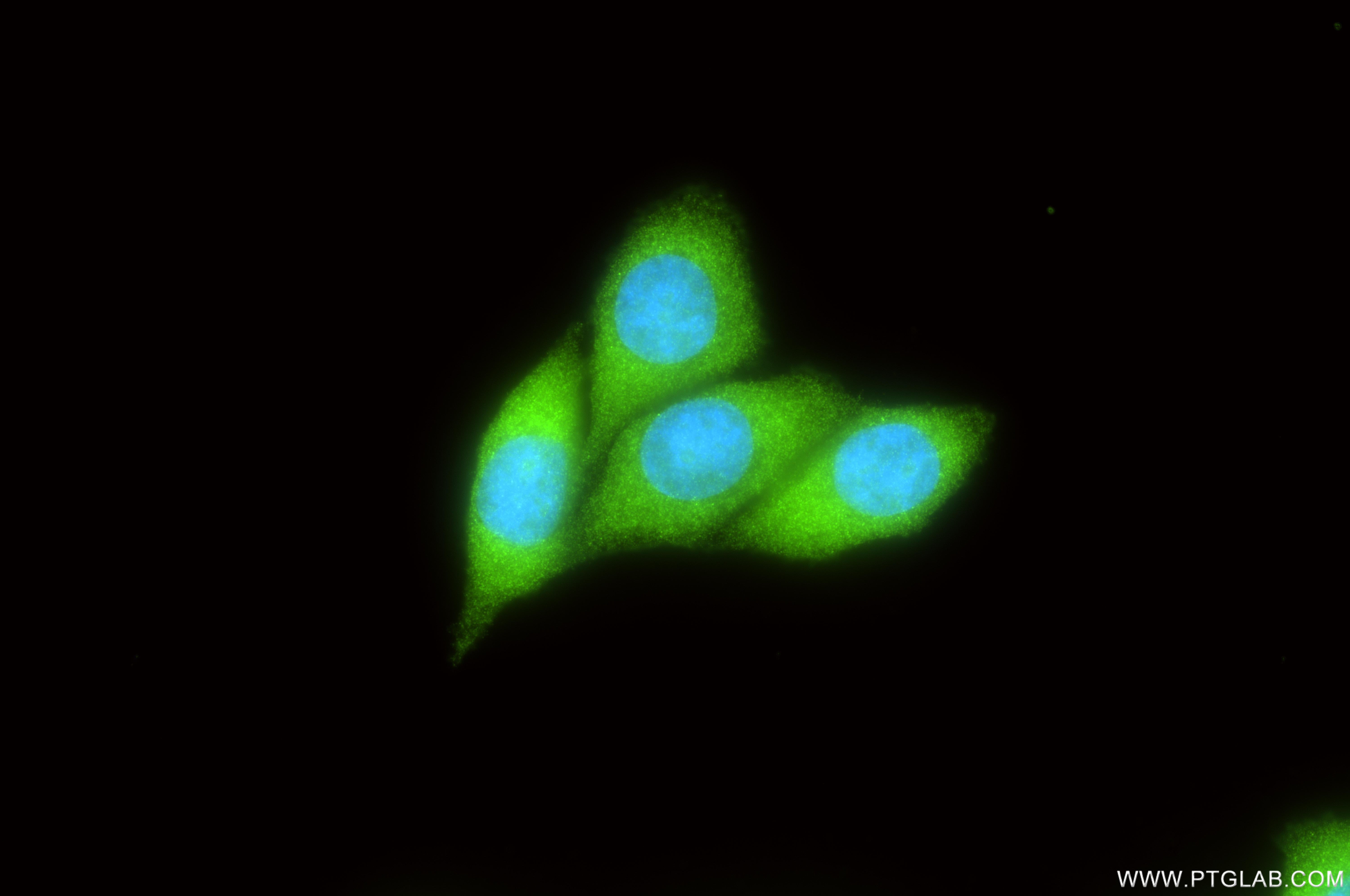 IF Staining of MCF-7 using 86883-1-RR IF Staining of MCF-7 using 86883-1-RR