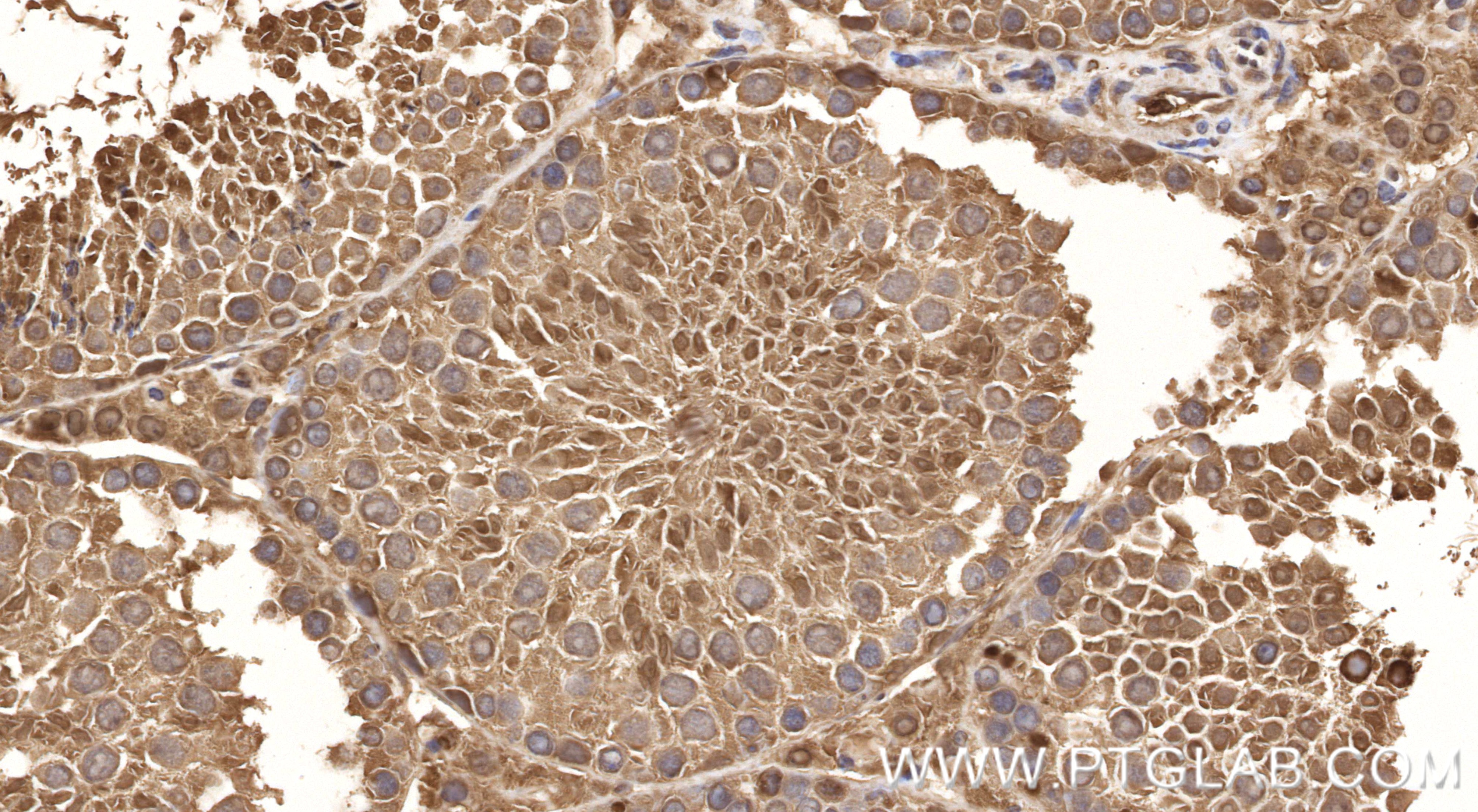 IHC staining of mouse testis using 86883-1-RR IHC staining of mouse testis using 86883-1-RR