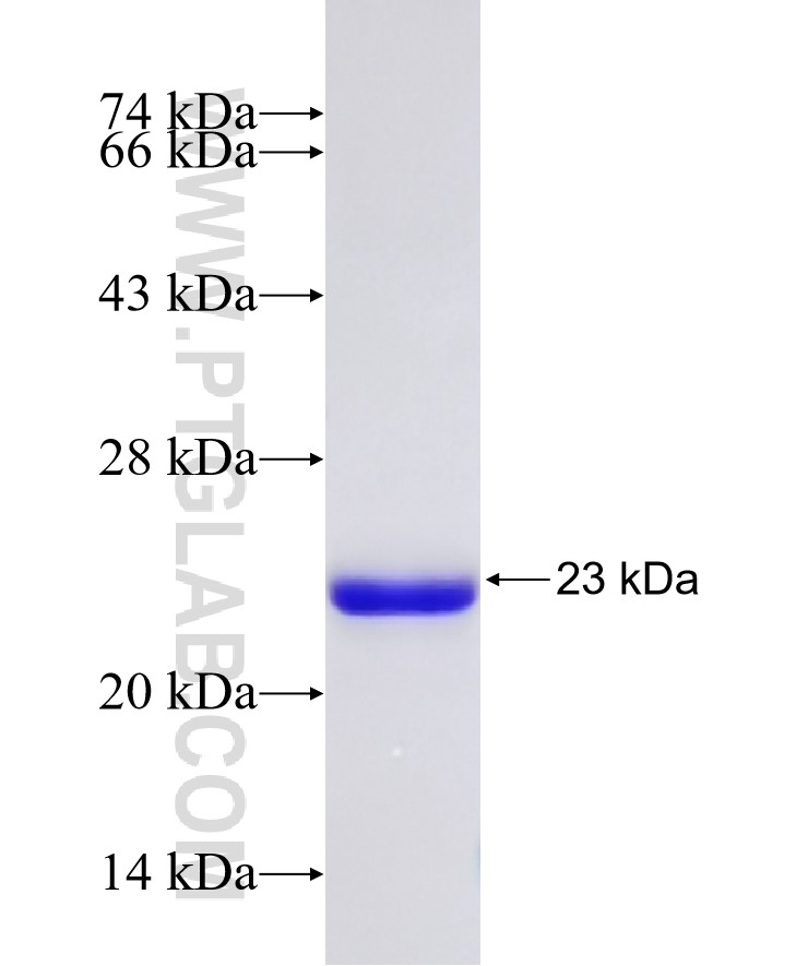 CCDC28A fusion protein Ag6865 SDS-PAGE