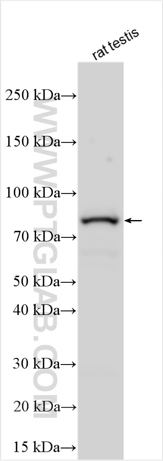 WB analysis using 25822-1-AP