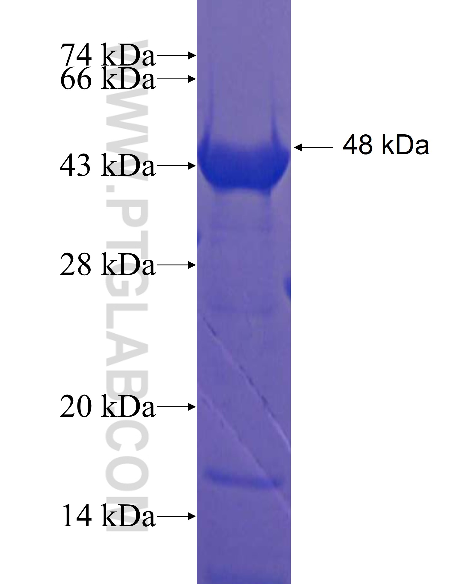 CCDC37 fusion protein Ag22686 SDS-PAGE