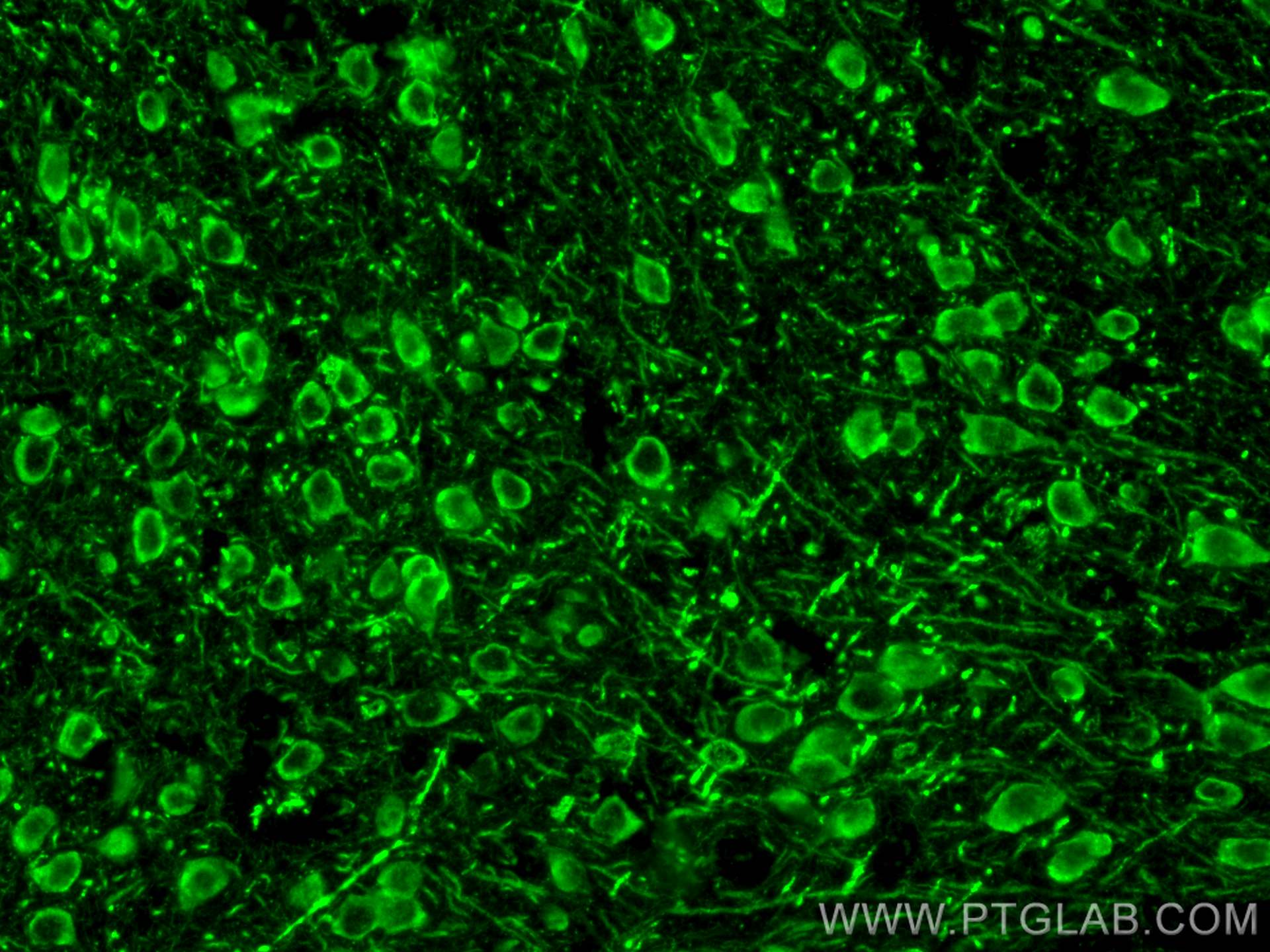 IF Staining of mouse brain using 29817-1-AP