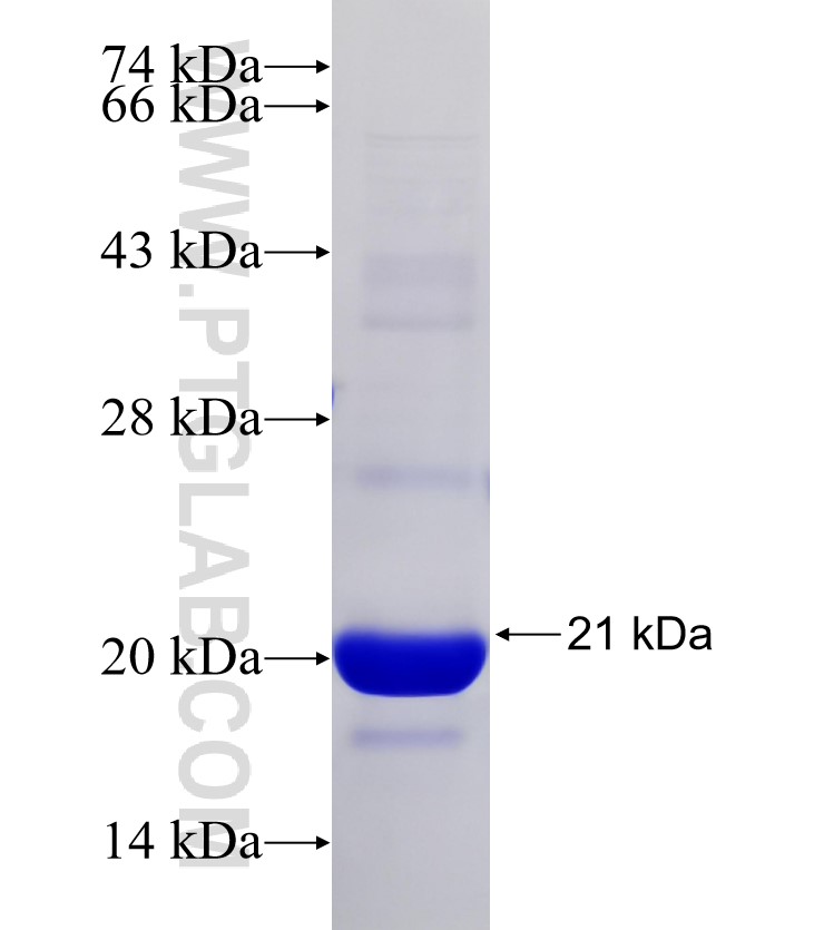 CCDC39 fusion protein Ag31121 SDS-PAGE CCDC39 fusion protein Ag31121 SDS-PAGE