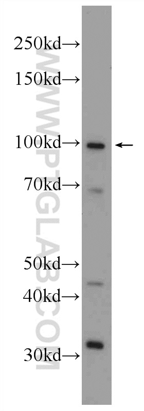 WB analysis of fetal human brain using 25049-1-AP