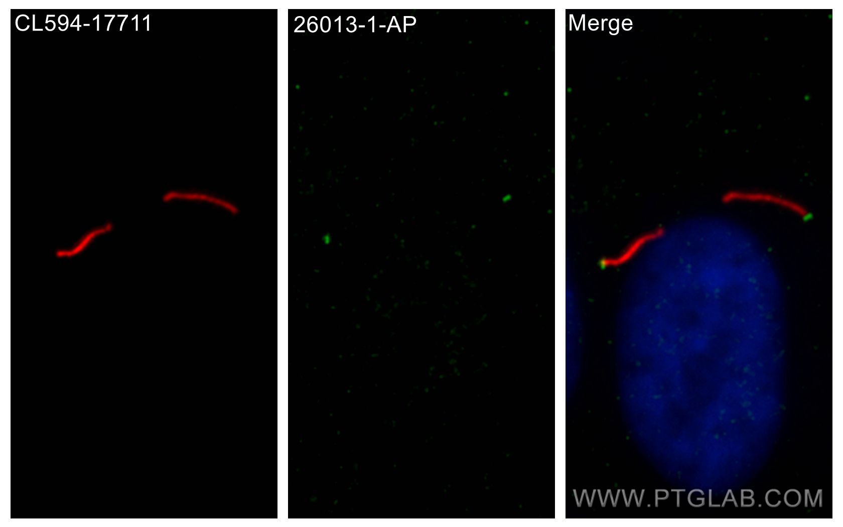 IF Staining of hTERT-RPE1 using 26013-1-AP