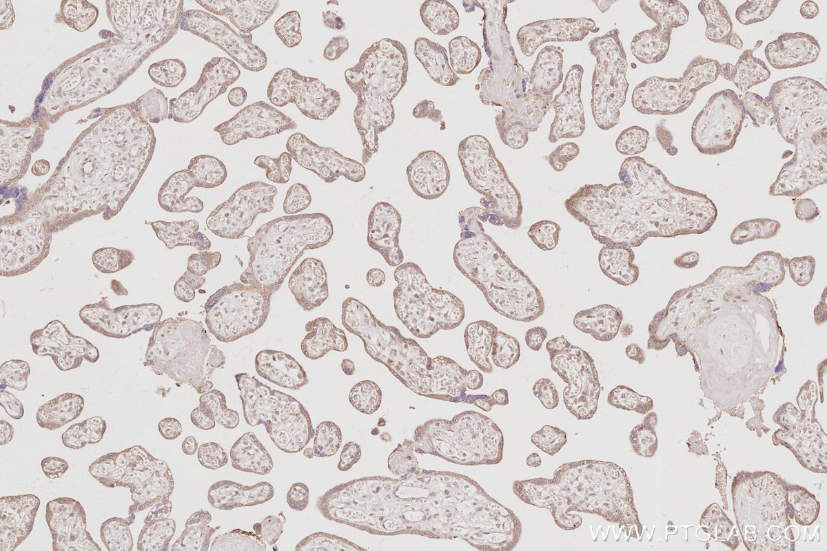 IHC staining of human placenta using 26013-1-AP IHC staining of human placenta using 26013-1-AP