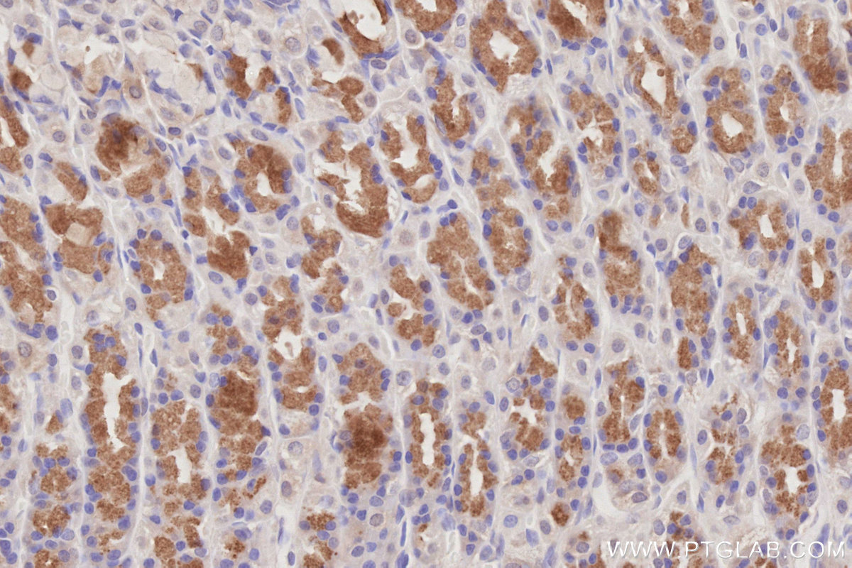IHC staining of rat stomach using 26013-1-AP IHC staining of rat stomach using 26013-1-AP