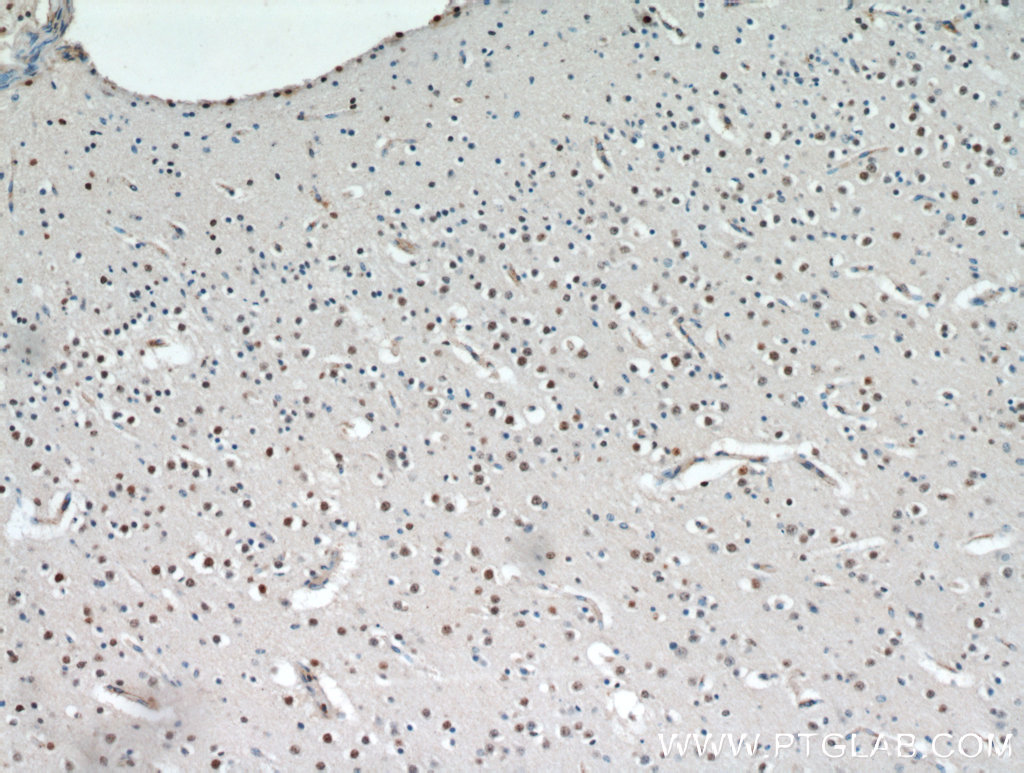 IHC staining of human brain using 20833-1-AP (same clone as 20833-1-PBS)