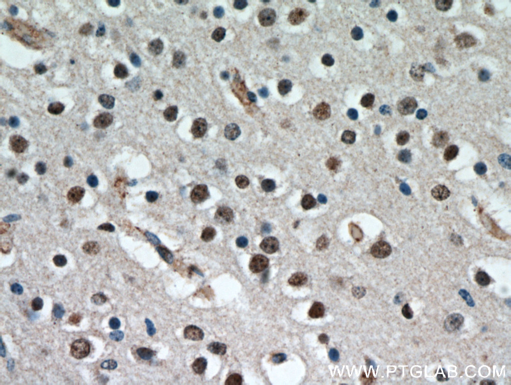 IHC staining of human brain using 20833-1-AP (same clone as 20833-1-PBS)
