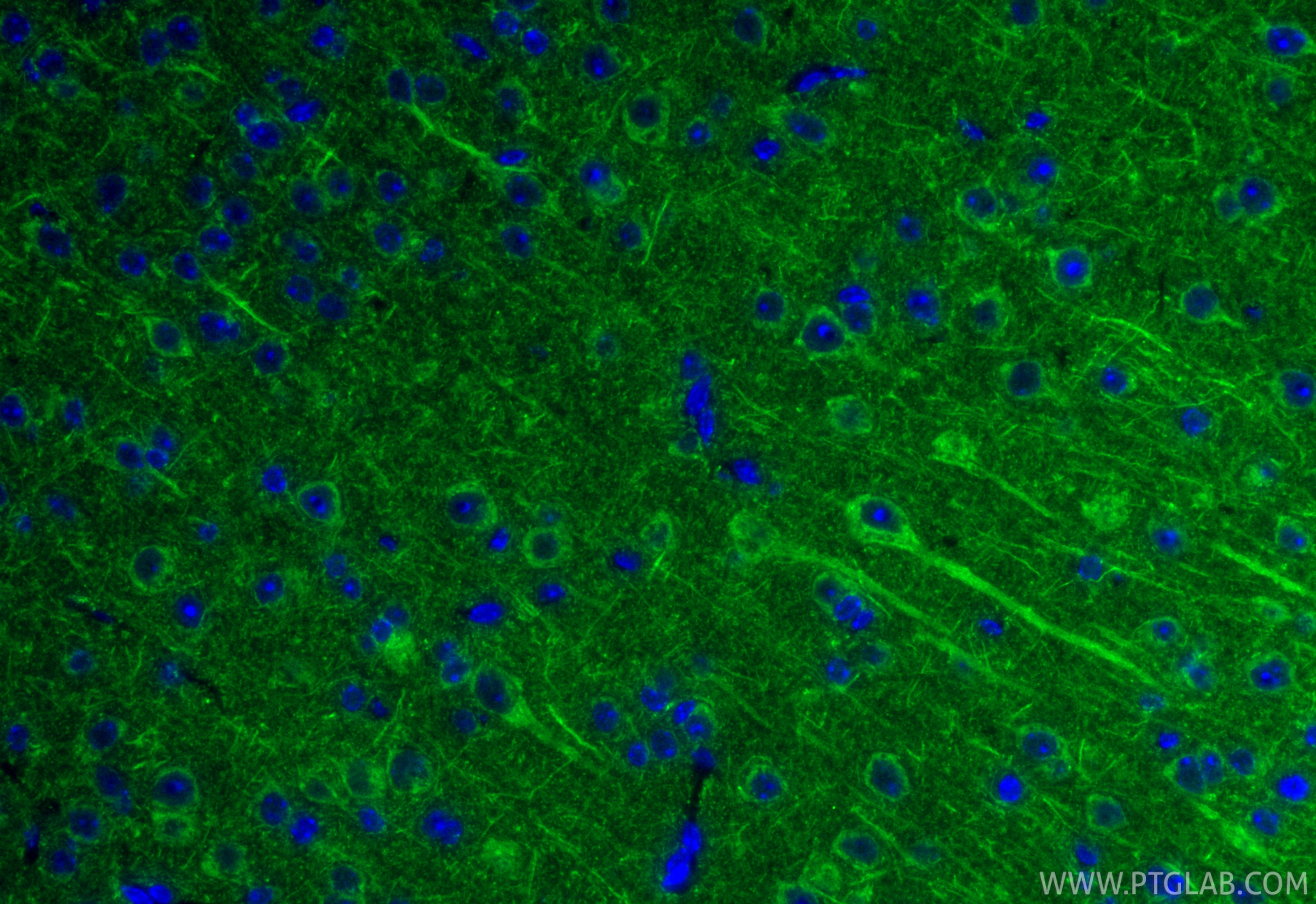IF Staining of mouse brain using 21147-1-AP IF Staining of mouse brain using 21147-1-AP
