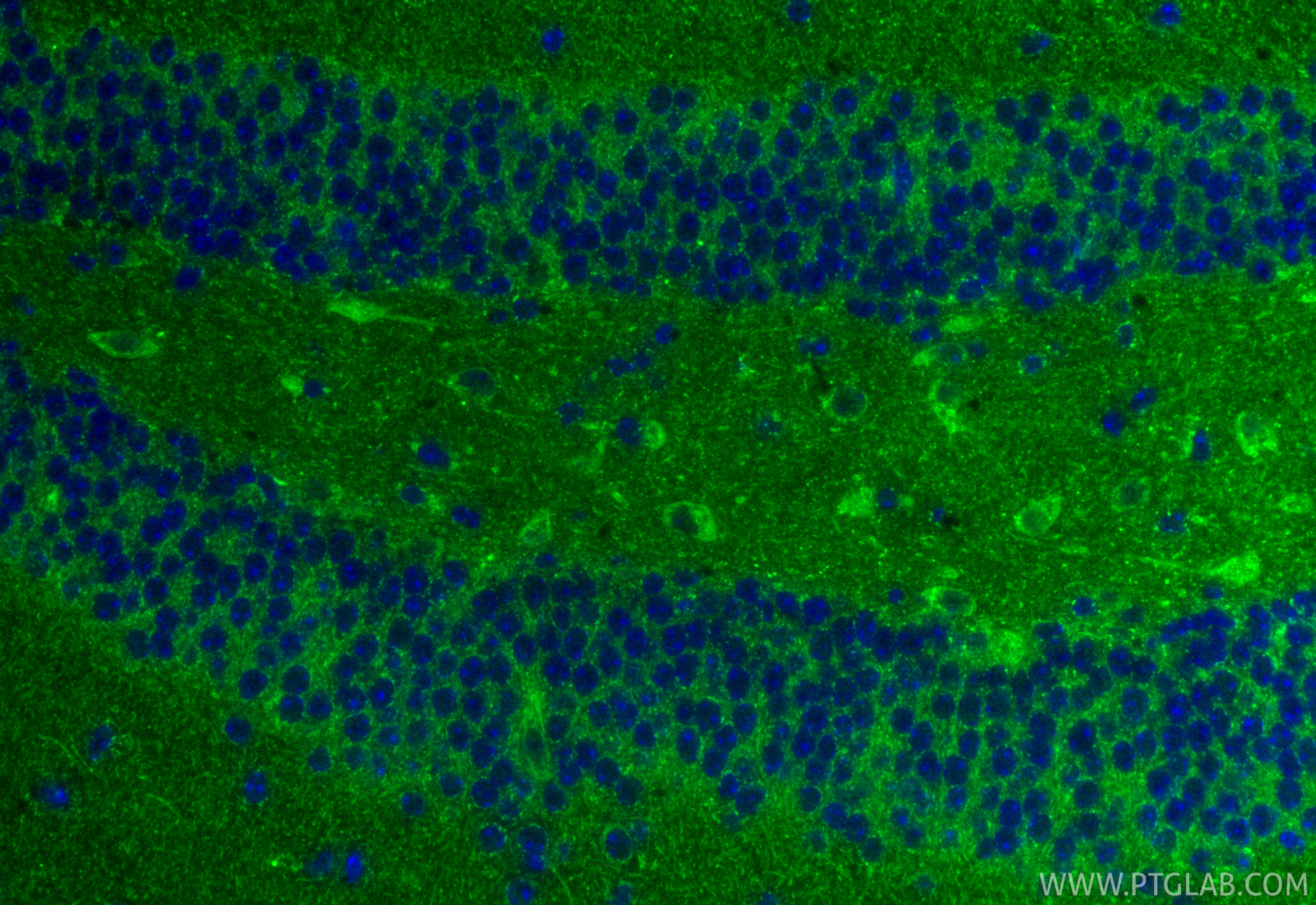 IF Staining of mouse brain using 21147-1-AP IF Staining of mouse brain using 21147-1-AP