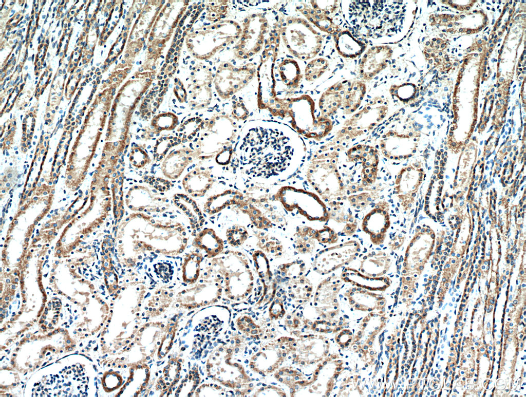 IHC staining of human kidney using 21147-1-AP