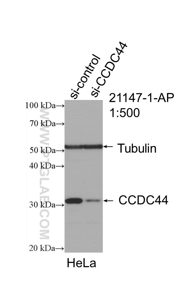 WB analysis of HeLa using 21147-1-AP