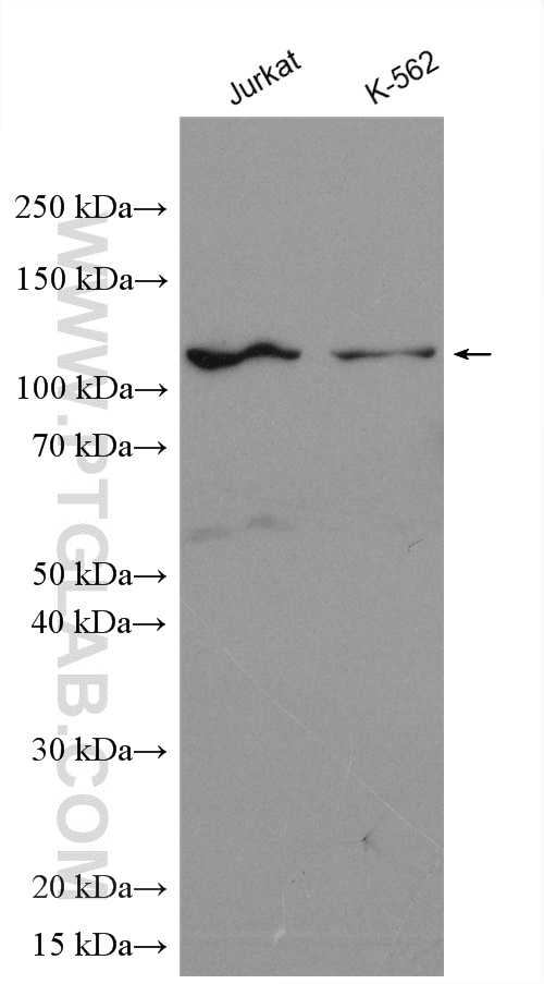 WB analysis using 28062-1-AP