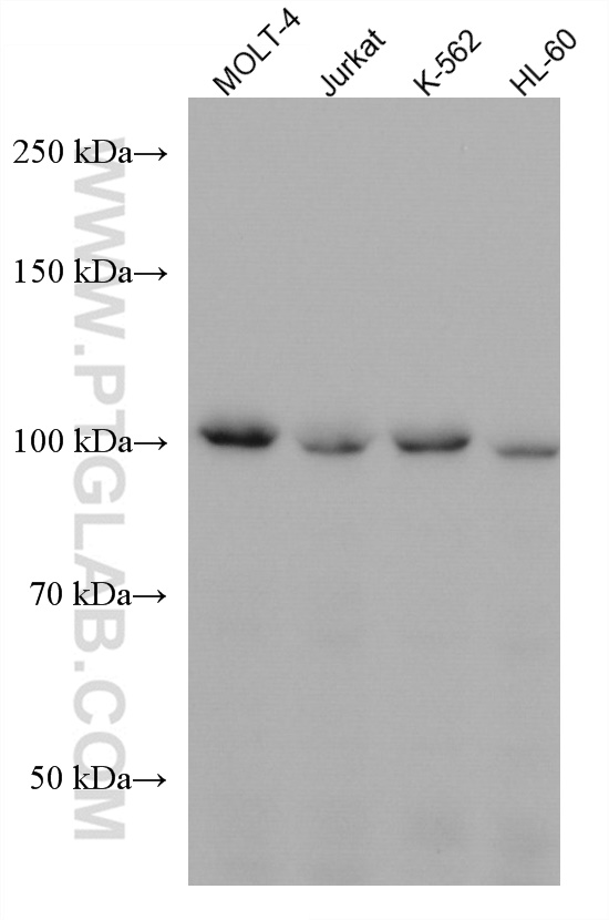 WB analysis using 67755-1-Ig