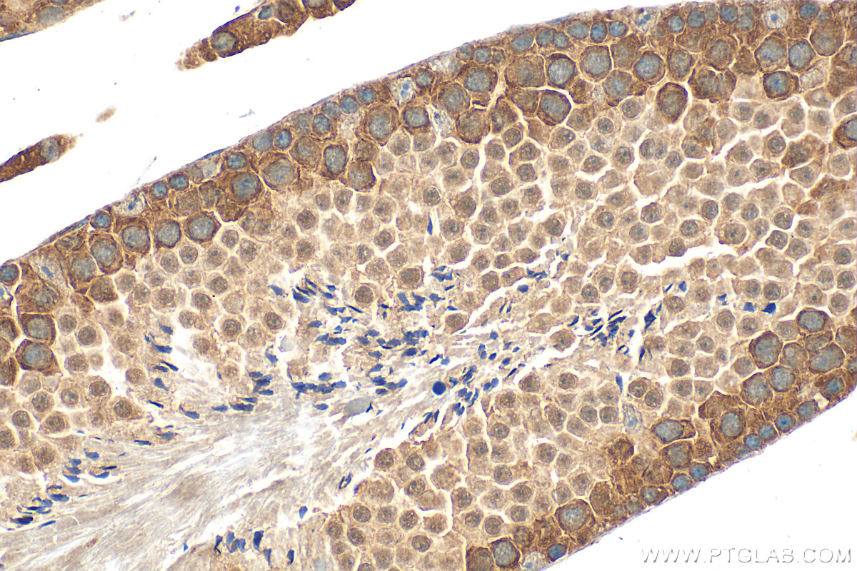 IHC staining of mouse testis using 32080-1-AP (same clone as 32080-1-PBS)