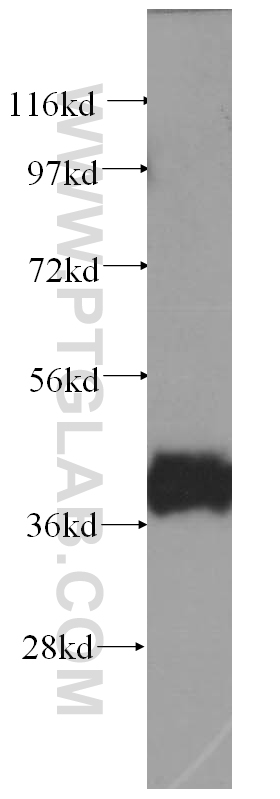 WB analysis of human skeletal muscle using 11094-2-AP