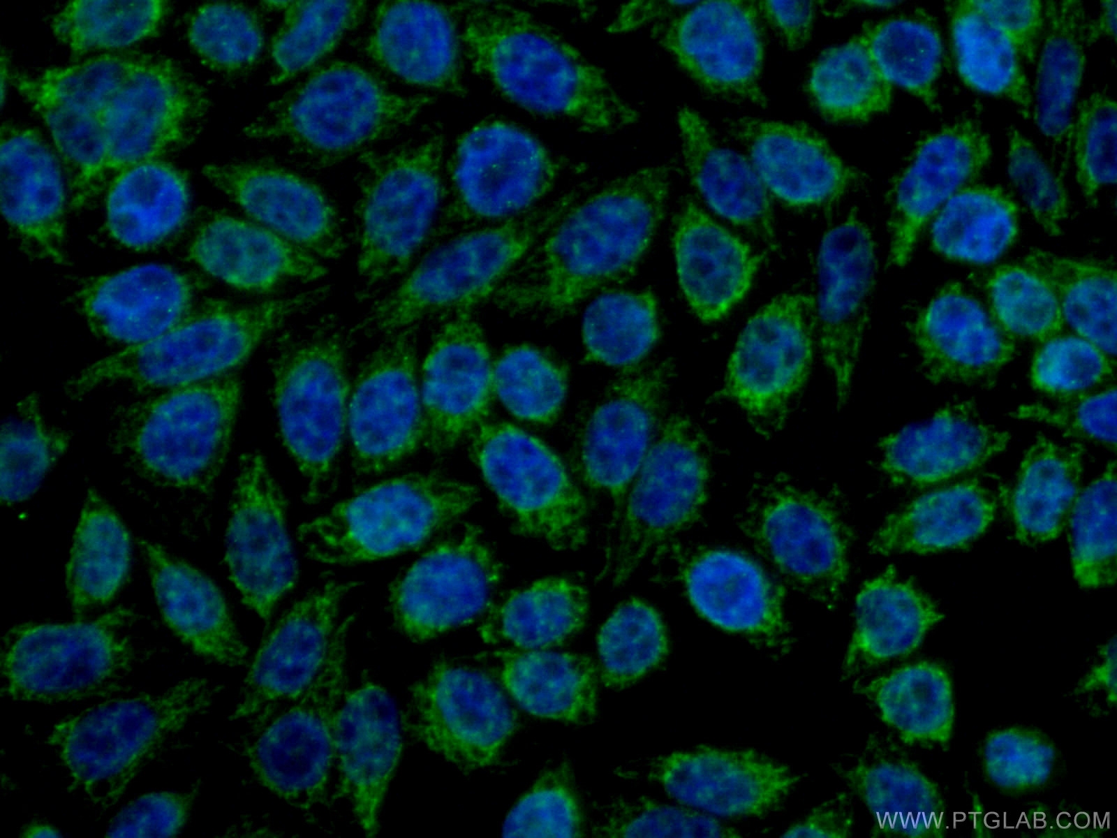 IF Staining of HeLa using 20465-1-AP