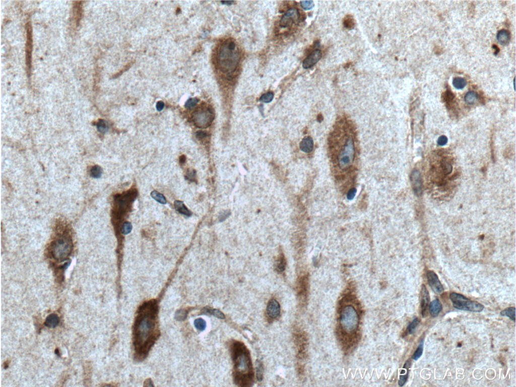 IHC staining of human brain using 21360-1-AP