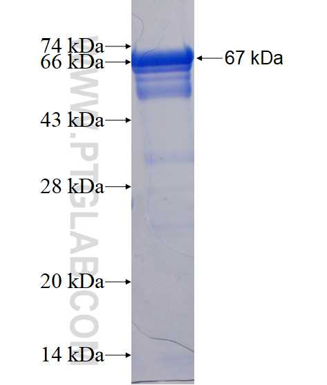 CCDC55 fusion protein Ag15811 SDS-PAGE