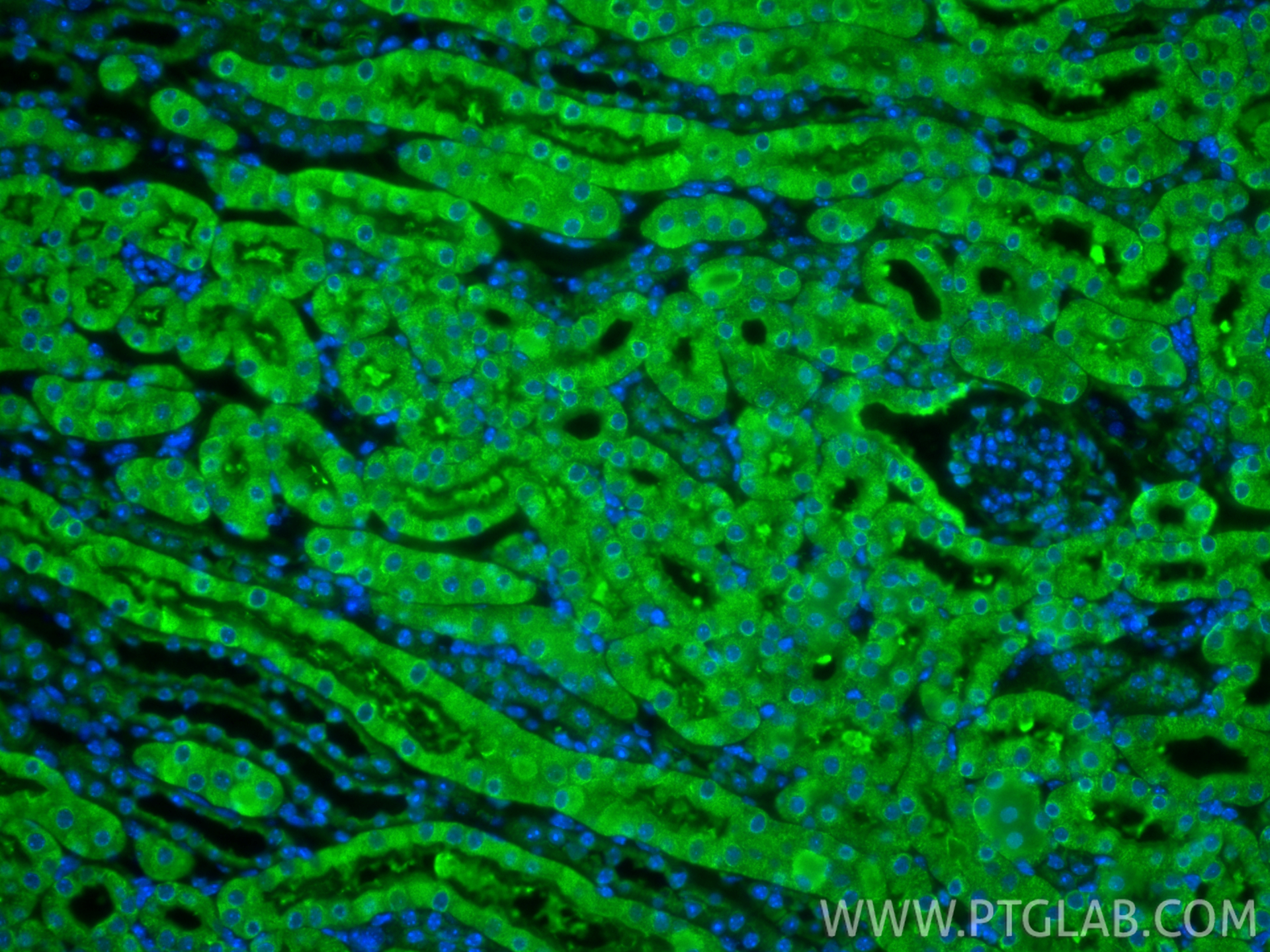 IF Staining of mouse kidney using 20427-1-AP IF Staining of mouse kidney using 20427-1-AP