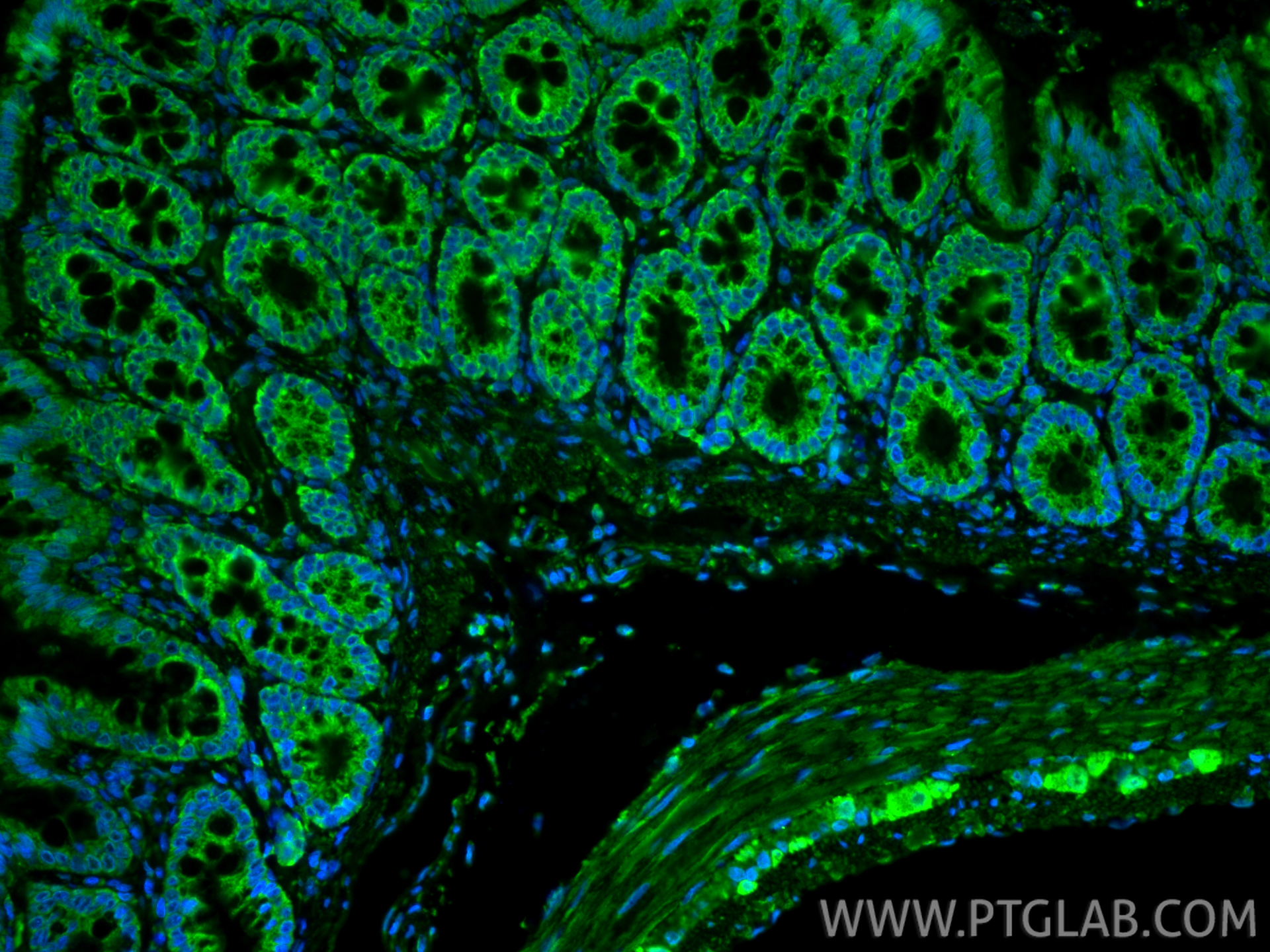 IF Staining of rat colon using 20427-1-AP IF Staining of rat colon using 20427-1-AP