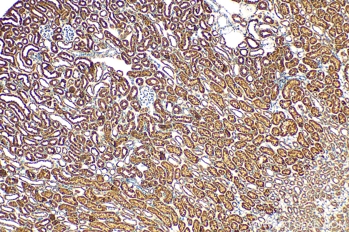 IHC staining of mouse kidney using 20427-1-AP