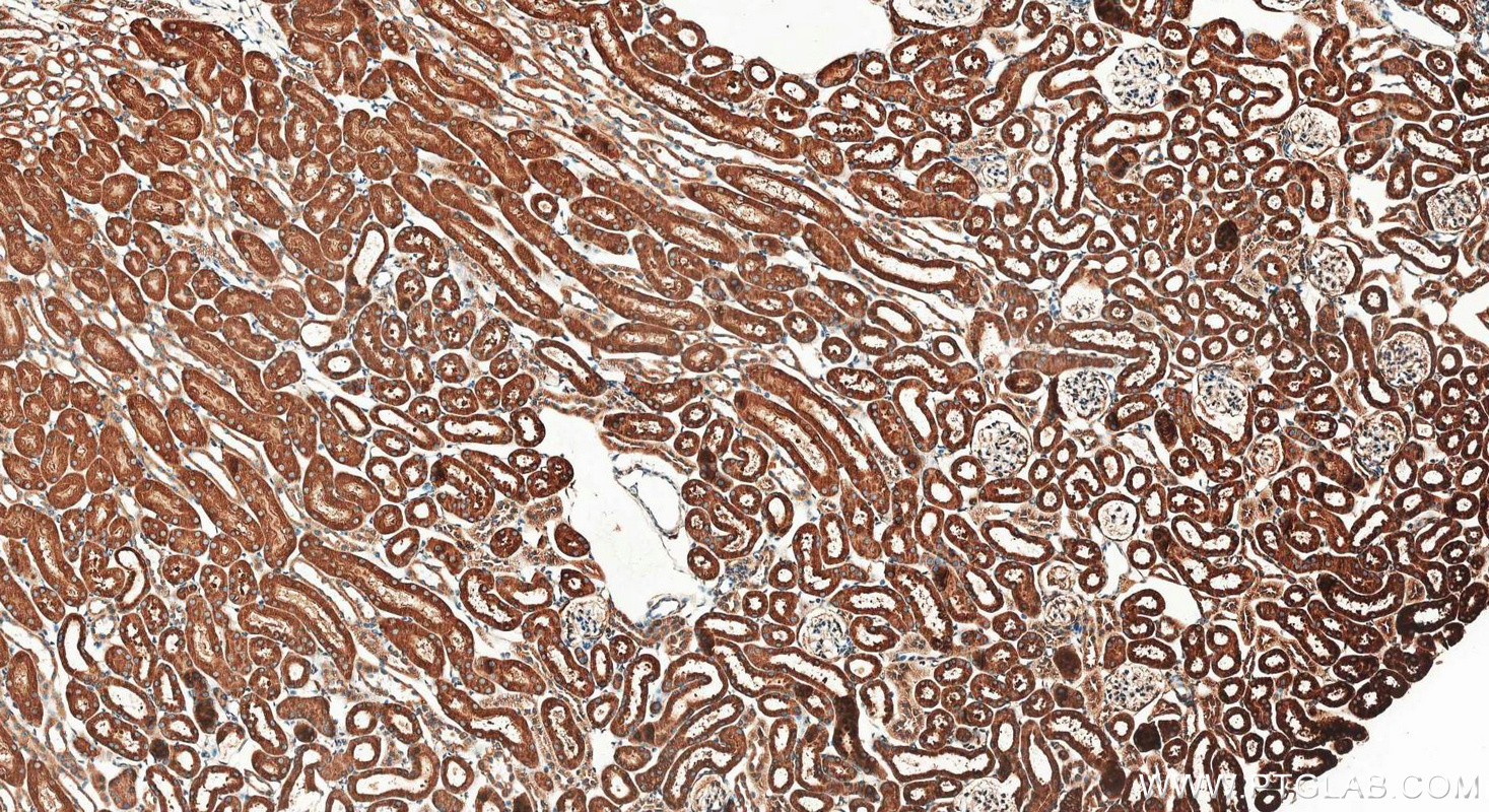 IHC staining of mouse kidney using 20427-1-AP IHC staining of mouse kidney using 20427-1-AP