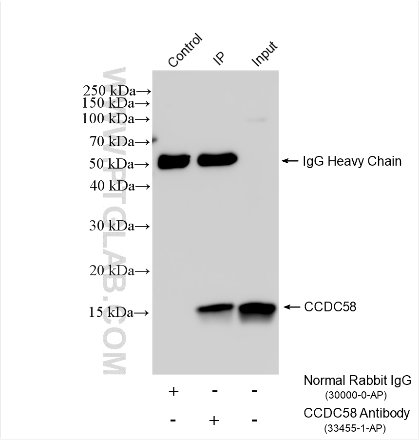 IP experiment of rat kidney using 33455-1-AP IP experiment of rat kidney using 33455-1-AP