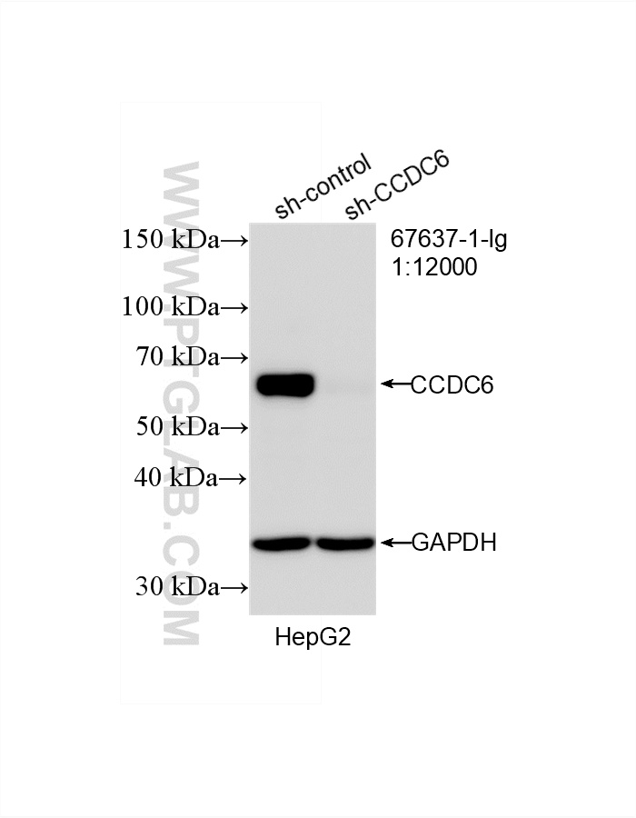 WB result of CCDC6 antibody (67637-1-Ig; 1:12000; incubated at room temperature for 1.5 hours) with sh-Control and sh-CCDC6 transfected HepG2 cells. WB analysis of HepG2 using 67637-1-Ig