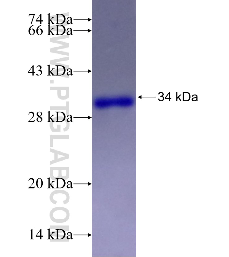 CCDC60 fusion protein Ag28109 SDS-PAGE