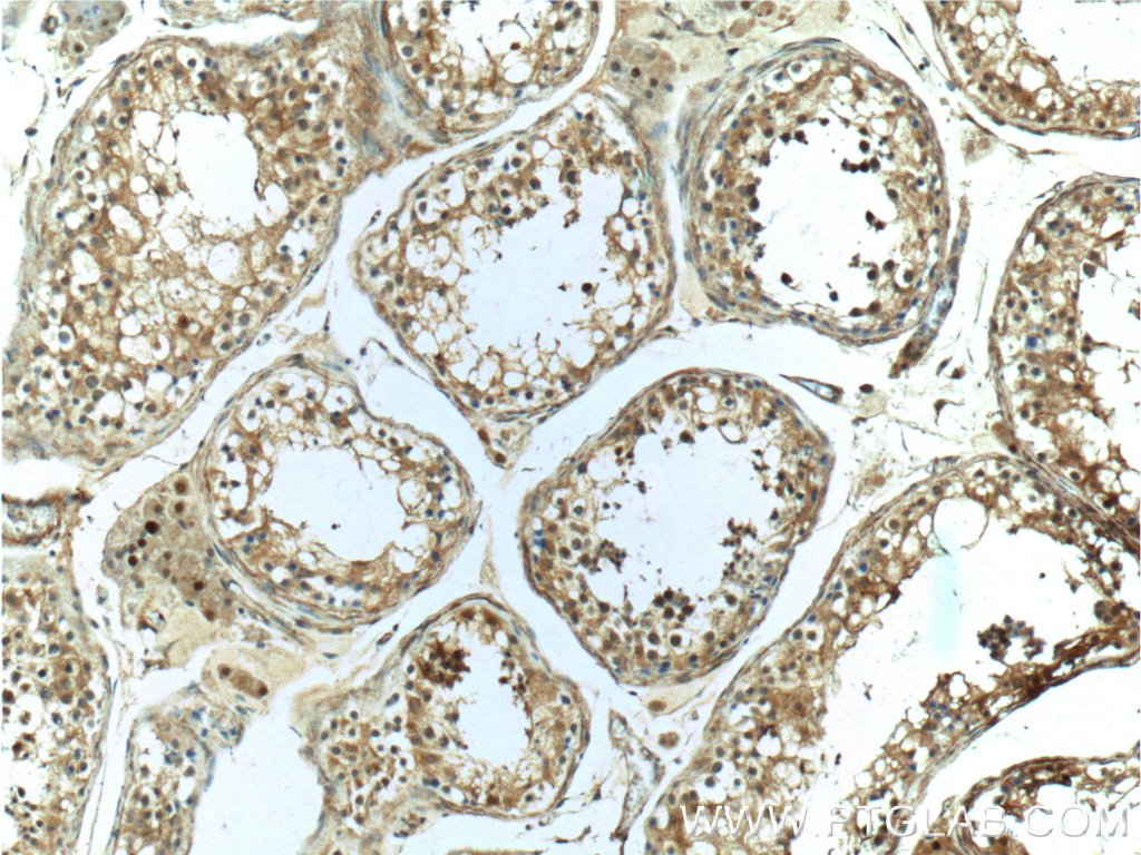 IHC staining of human testis using 25981-1-AP
