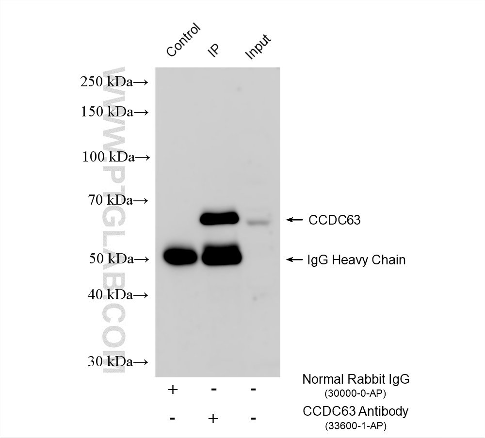 IP result of anti-CCDC63 (IP:33600-1-AP, 4ug; Detection:33600-1-AP 1:600) with mouse testis tissue lysate 1680 ug. IP experiment of mouse testis using 33600-1-AP