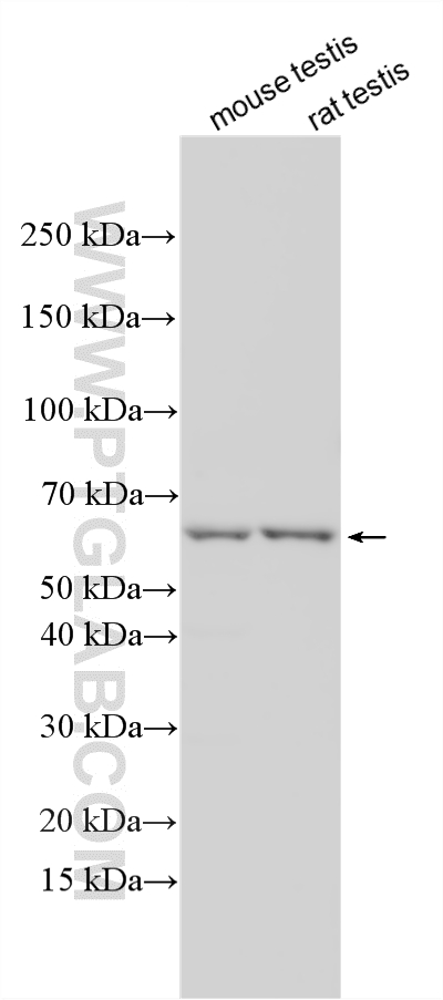 Various lysates were subjected to SDS PAGE followed by western blot with 33600-1-AP (CCDC63 antibody) at dilution of 1:1000 incubated at room temperature for 1.5 hours. WB analysis using 33600-1-AP