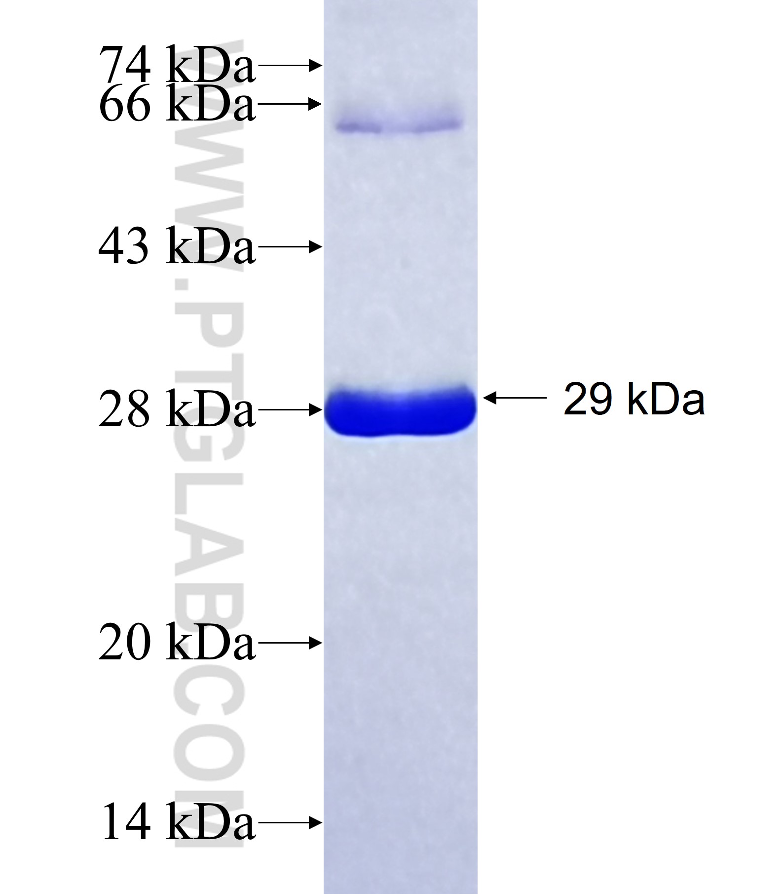 CCDC63 fusion protein Ag39259 SDS-PAGE CCDC63 fusion protein Ag39259 SDS-PAGE