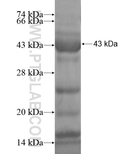 CCDC64B fusion protein Ag19121 SDS-PAGE CCDC64B fusion protein Ag19121 SDS-PAGE