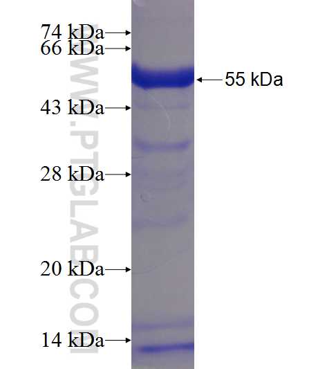 CCDC66 fusion protein Ag23432 SDS-PAGE CCDC66 fusion protein Ag23432 SDS-PAGE